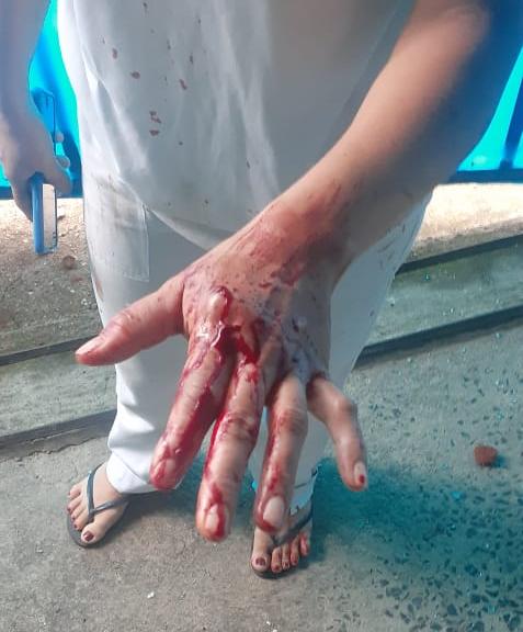foto de Homem usa barra de ferro para agredir pai e madrasta no Santa Maria do Amparo